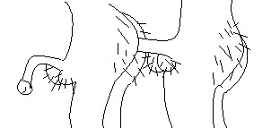 Газенваген