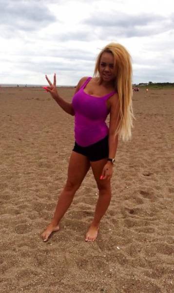 Девушка переборщила с ботексом и силиконом