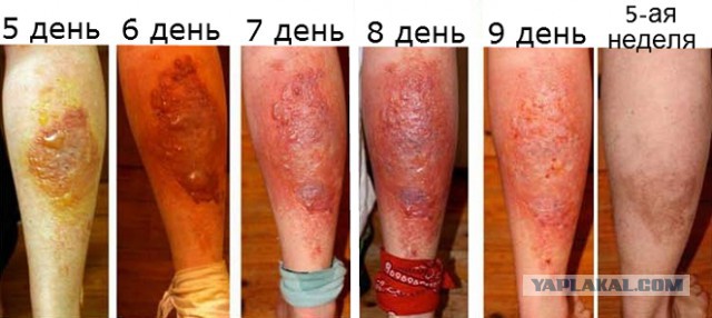 Жаль девушку