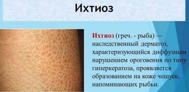Радиостанция Судного дня выдала в эфир загадочное слово "дымоскальп"