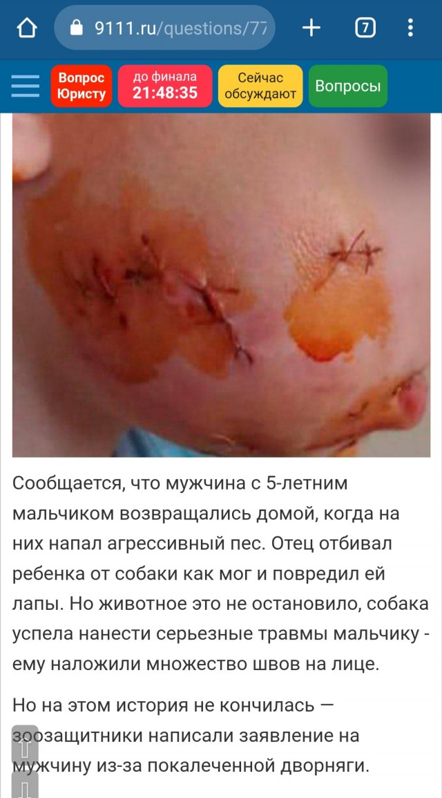 В Приморье бездомная собака напала и изуродовала ребенка, а зоозащитники написали заявление на отца, который спас сына