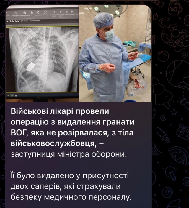 Хирурги под наблюдением саперов достали из тела бойца гранату ВОГ