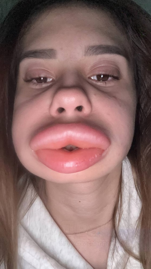 Сколько опыта и голды дадут за этого моба?⁠⁠