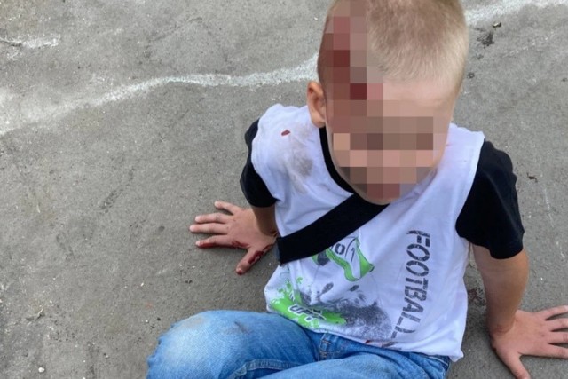 «Практически невозможная ситуация»: полиция признала 7-летнего ребенка виновником ДТП — машина сбила его возле подъезда