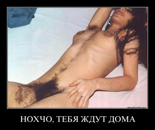 Эпиляция