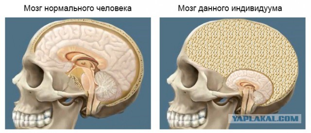 Как открыть машину без ключей