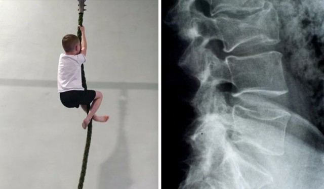 «Иди посиди, симулянт»: учительница физкультуры отказала в помощи сломавшему позвоночник ученику в Новосибирске