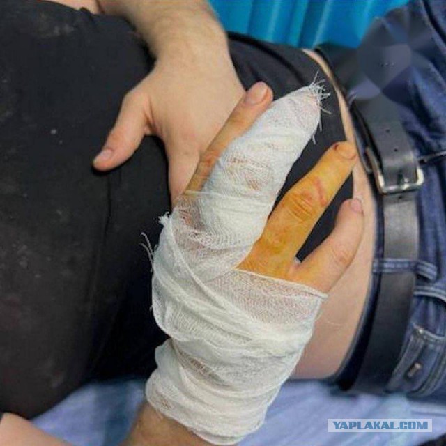 В Краснодаре закладчики напали на полицейских, которые пытались их задержать