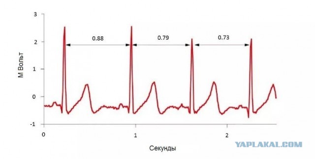 Пандемия съехавших крыш - разновидности болезни. Россия и мир. Часть 44.