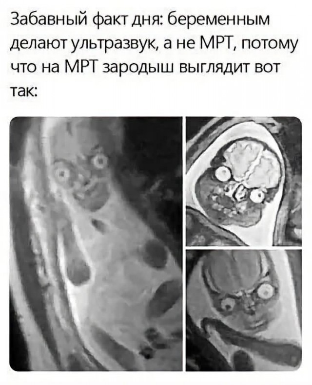 Коллеги, не для беременных картинка.