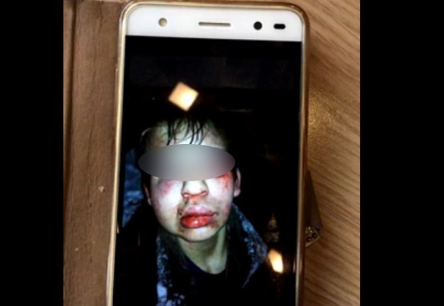 Девятиклассники толпой избили парня