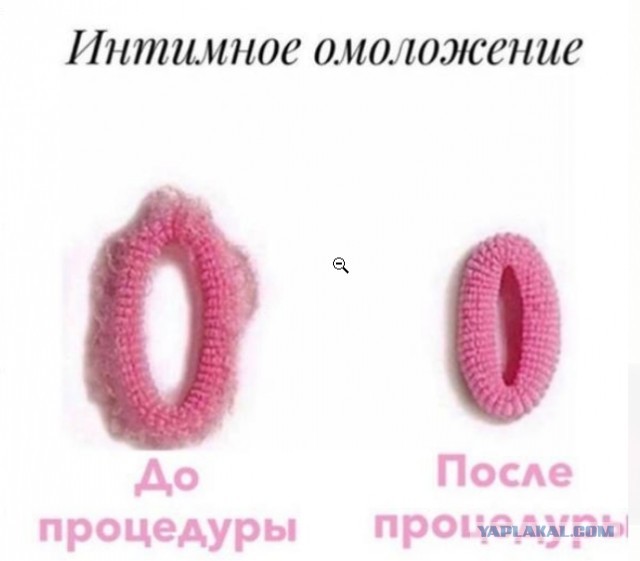 Можно ли увеличить размер мужского начала и почему не стоит этого делать?