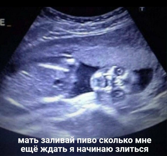 Так себе картинки 20.06.23
