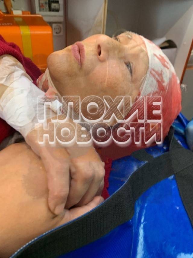 Жуткие кадры: На Урале 16-летний подросток на электросамокате сбил 70-летнюю пенсионерку
