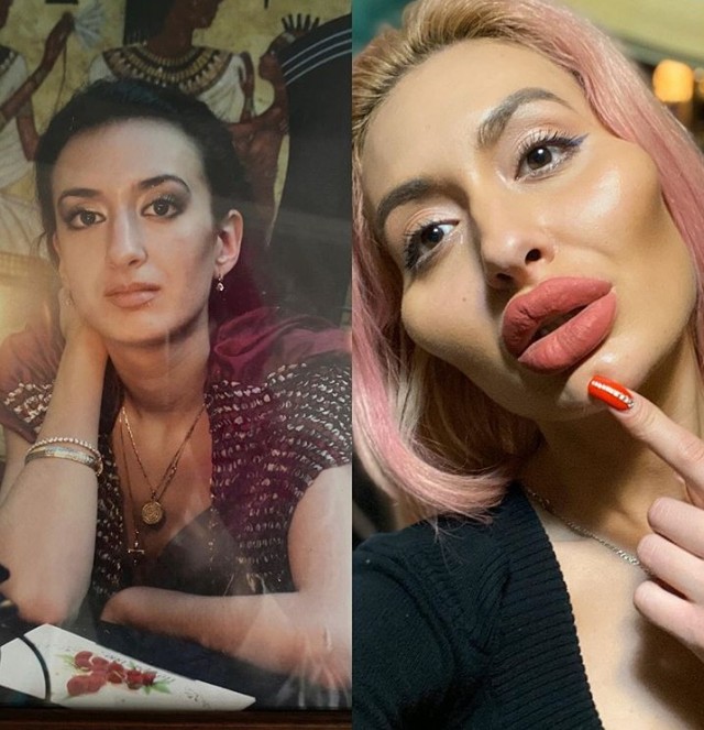 Скулы базуки