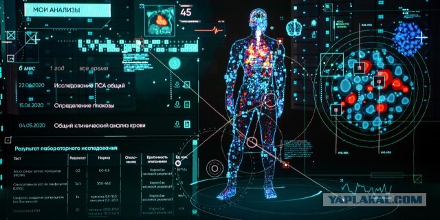 Про вчерашнюю вышку 5G, с обратной стороны