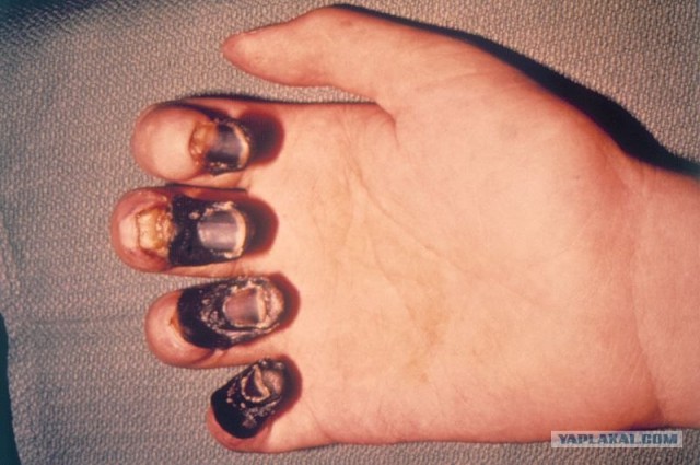 Дайвер спас рыбу-шар