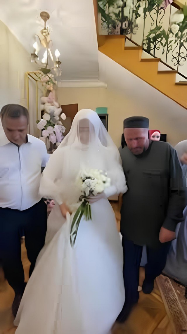 Дагестанец отменил свадьбу после того, как увидел фотки невесты до пластики и уколов красоты