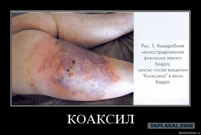 Селфи врачей «скорой» с окровавленным пациентом