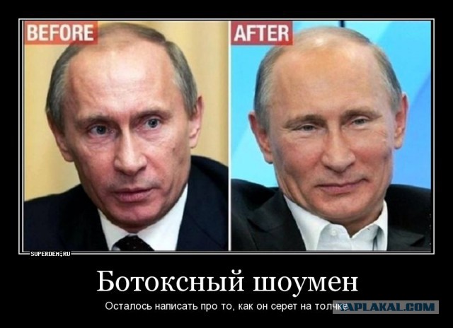 10 худших пластических операций знаменитостей