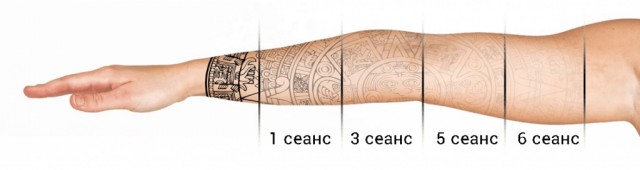 Когда хочется удалить ошибки молодости