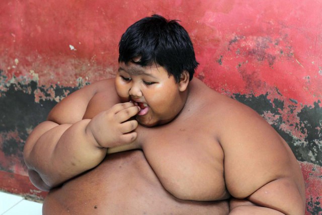 10-летнего мальчика весом 192 кг экстренно посадили на диету