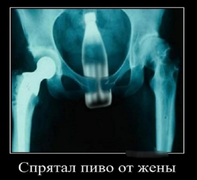 Неухоженные женщины