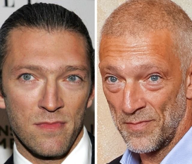 Крупным планом: как со временем изменились лица знаменитостей