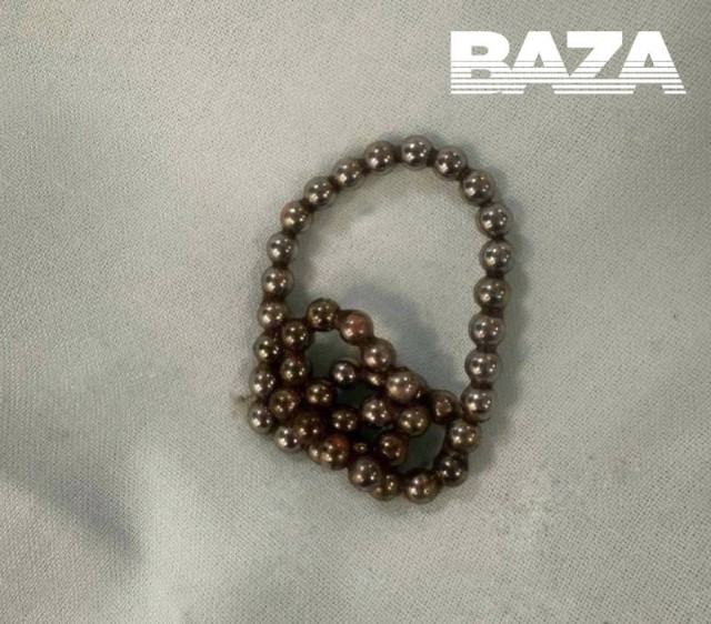 Восьмилетней девочке стало ТАК скучно в дороге, что она проглотила магнитные шарики, которые родители купили ей для развлечения