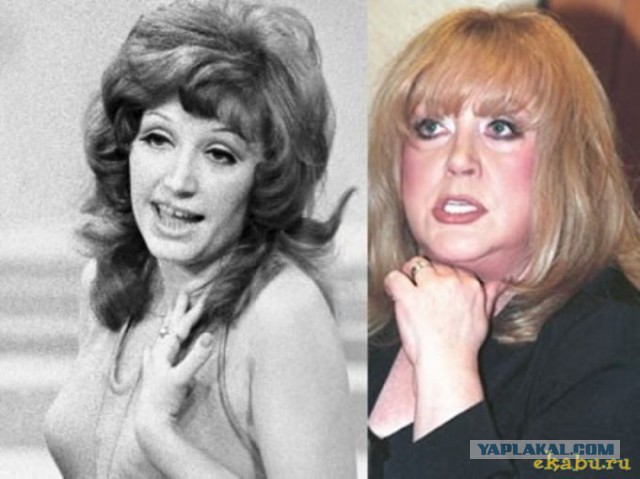 Знаменитости, которые безобразно стареют