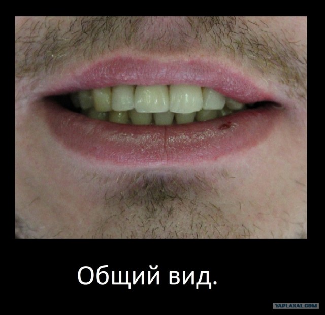 Как делают МК коронки
