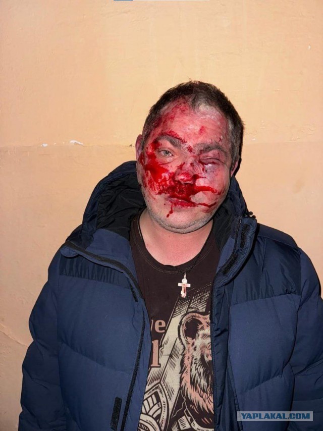 В Крыму избили посетителей кафе