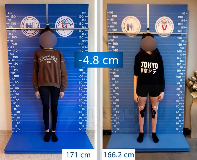 В Стамбуле растёт интерес к операциям по укорочению ног