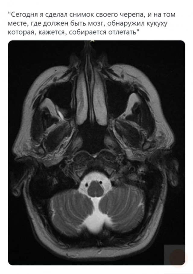 Деградильня