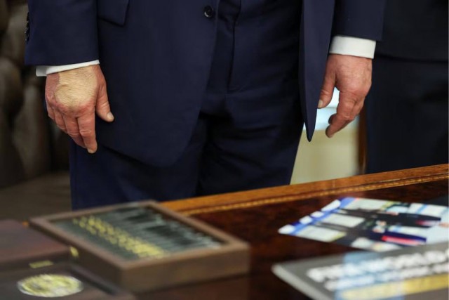 На руке у Трампа вновь заметили синяк, который он попытался скрыть тональным кремом.