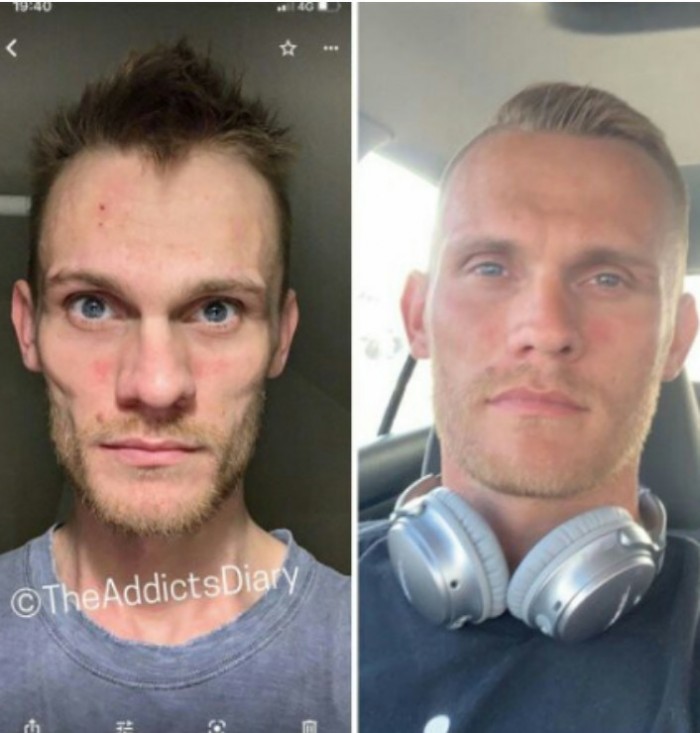 Фотографии людей до и после того, как им удалось избавиться от наркотической зависимости