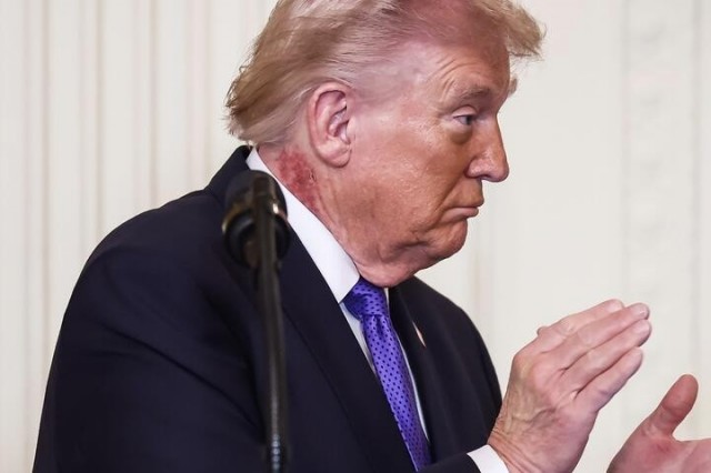 Трамп вновь пытается ограничить гражданство по праву рождения и «родильный туризм»