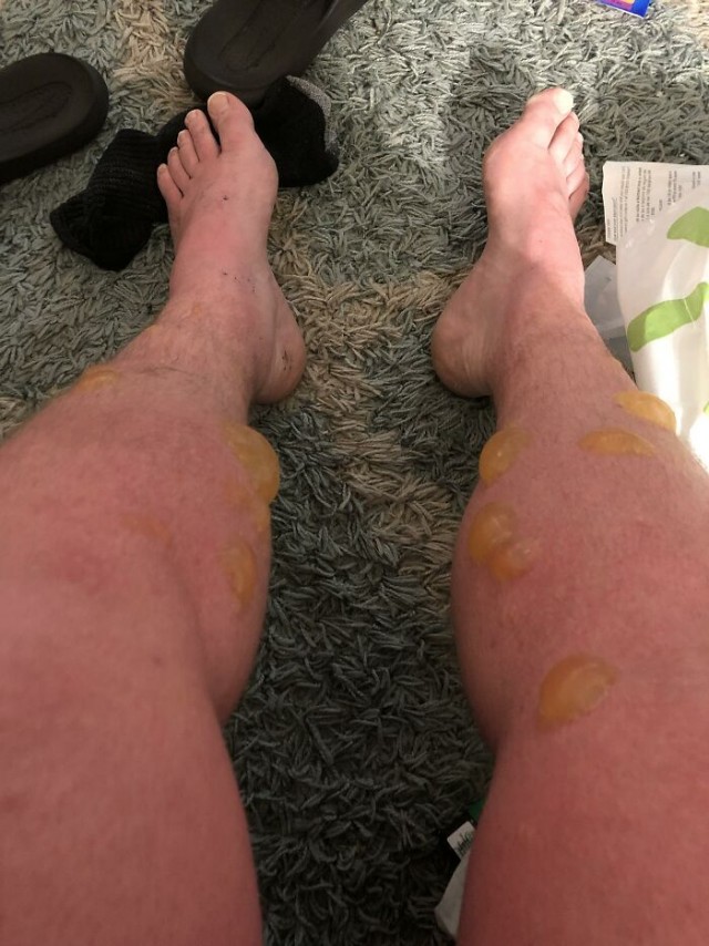 Подборка фотографий, некоторые из них заставят вас сморщиться от неприязни
