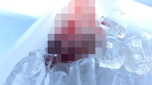 24-летняя жена узнала об измене мужа, отрезала пенис, который выбросила в окно