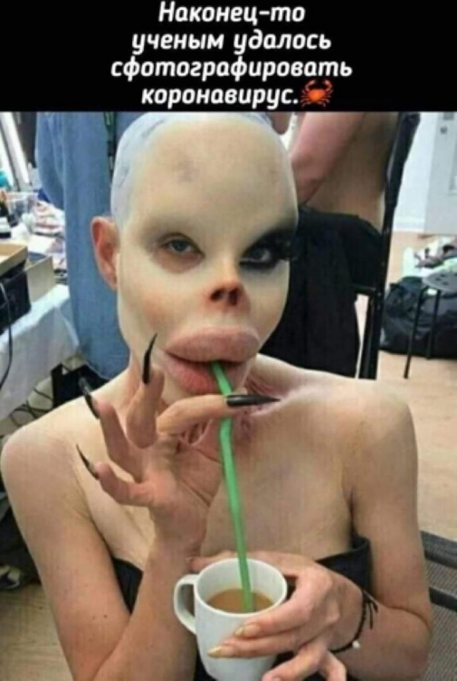 Ну и ну! Ей пришили ж@пу бабуина!