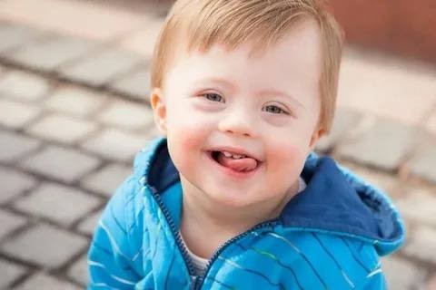 Японские ученые с помощью CRISPR удалили лишнюю хромосому у людей с синдромом Дауна