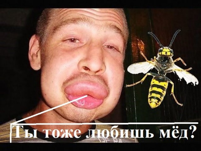 Москвичка не могла принять свою внешность и десятки раз увеличивала губы
