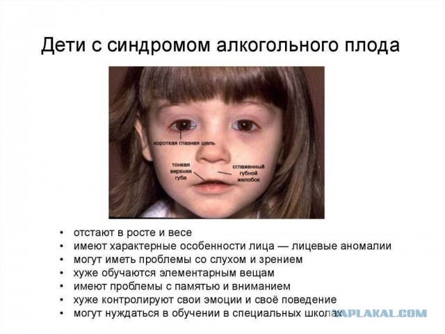 - Алкоголиками могут быть, только самые здоровые