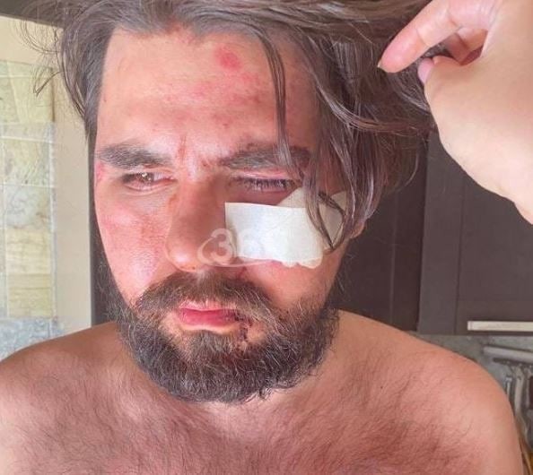 Вступился за честь и едва не погиб. 10 человек избили балашихинца за верность его девушки