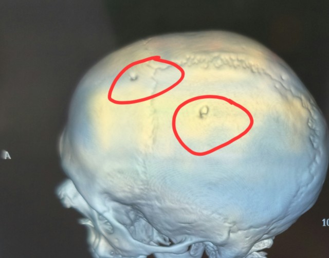 Как-то было про еду в больнице
