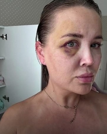 "Я оболью тебя кислотой и уеду на СВО и мне ничего не будет"