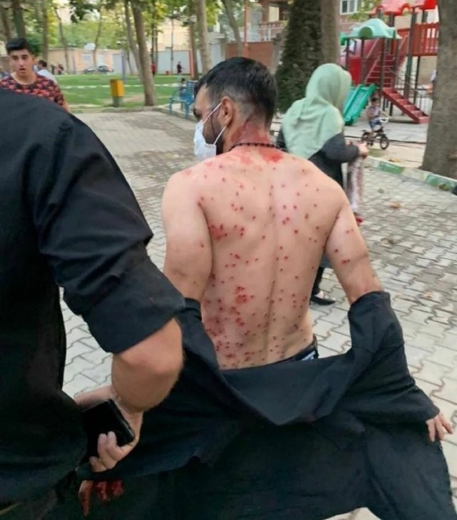 Во время протеста против ношения хиджаба в Тегеране мужчина заслонил собой нескольких женщин и взял на себя всю дробь из дробовика