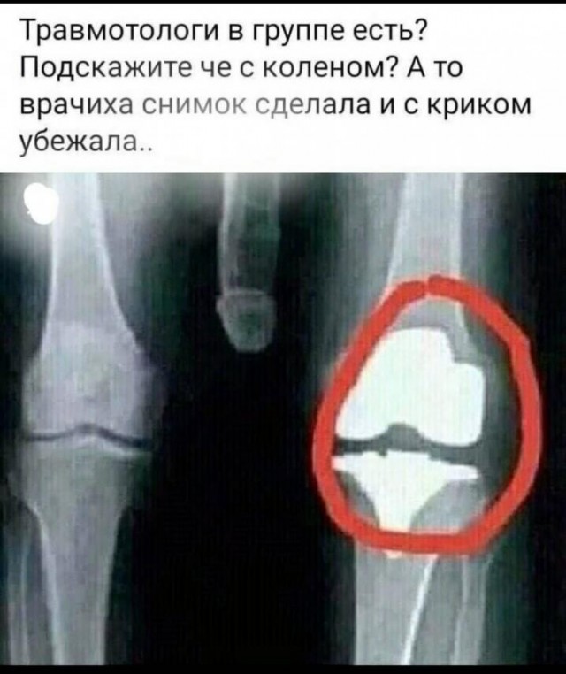 Бредзона 08.02.2021