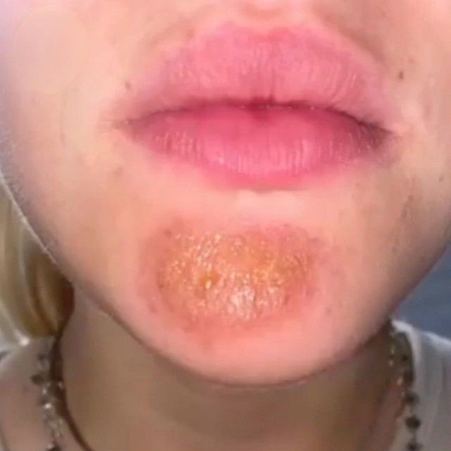 Поцелуи с бородатыми парнями могут обернуться неприятными последствиями