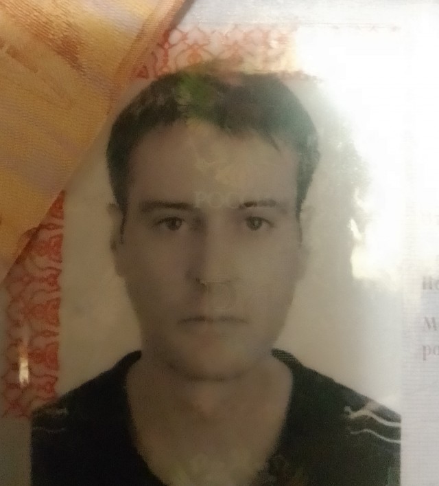 Этапы омоложения лица наглядно.